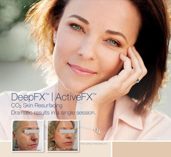 ActiveFX specials