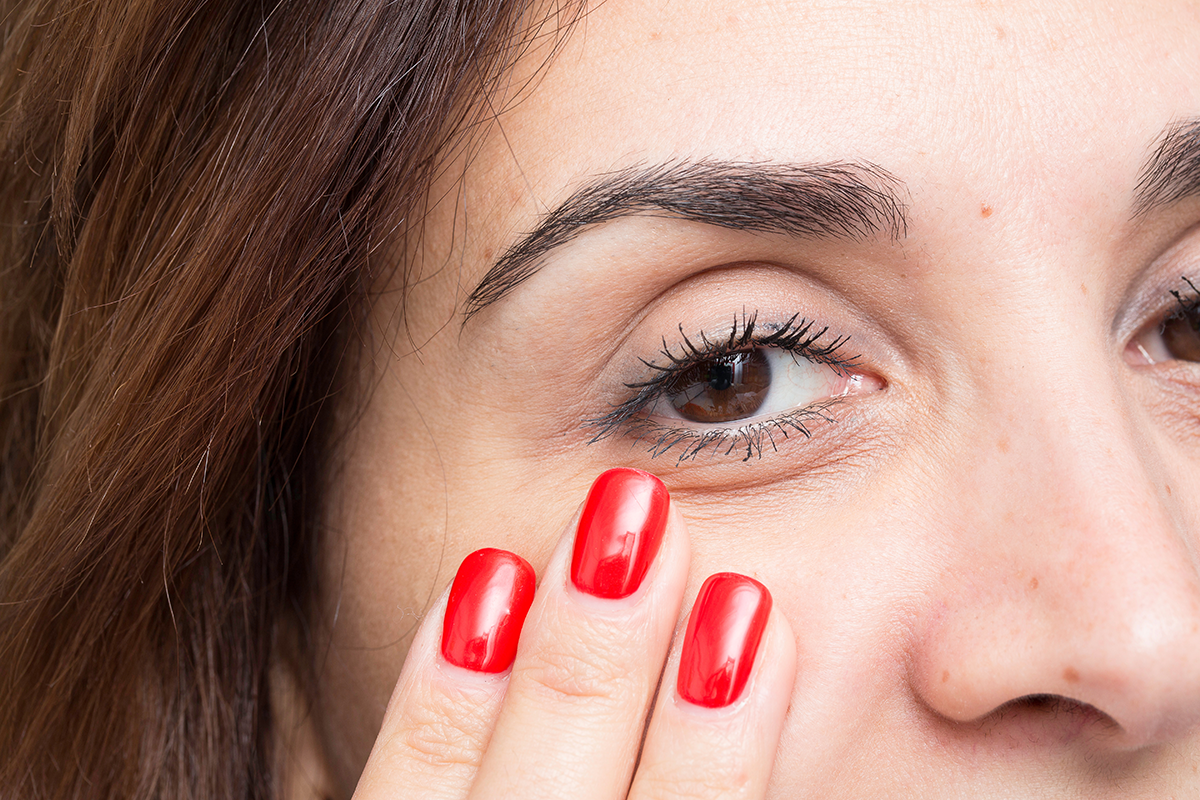 Close up of female eye with drooping eyelid, amblyopia condition called lazy eye Close up of female eye with drooping eyelid, amblyopia condition called lazy eye