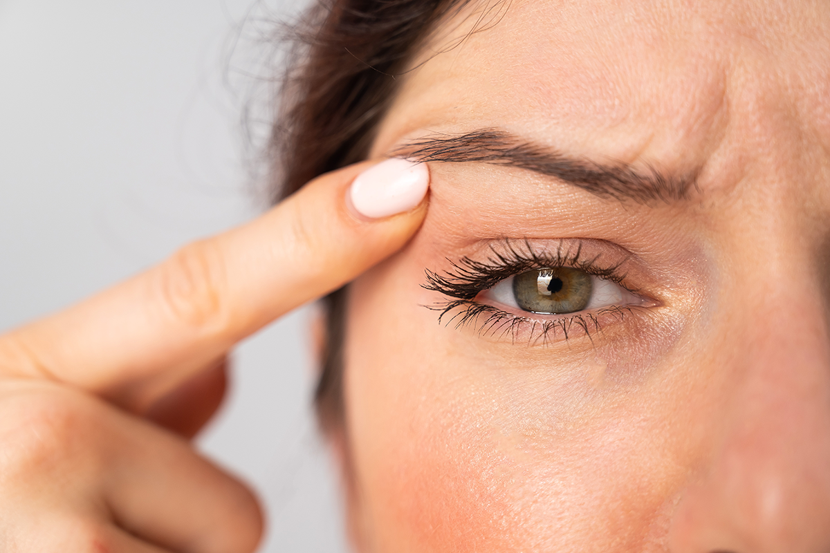 Close-up portrait of Caucasian middle-aged woman pointing to the wrinkles on the upper eyelid Close-up portrait of Caucasian middle-aged woman pointing to the wrinkles on the upper eyelid