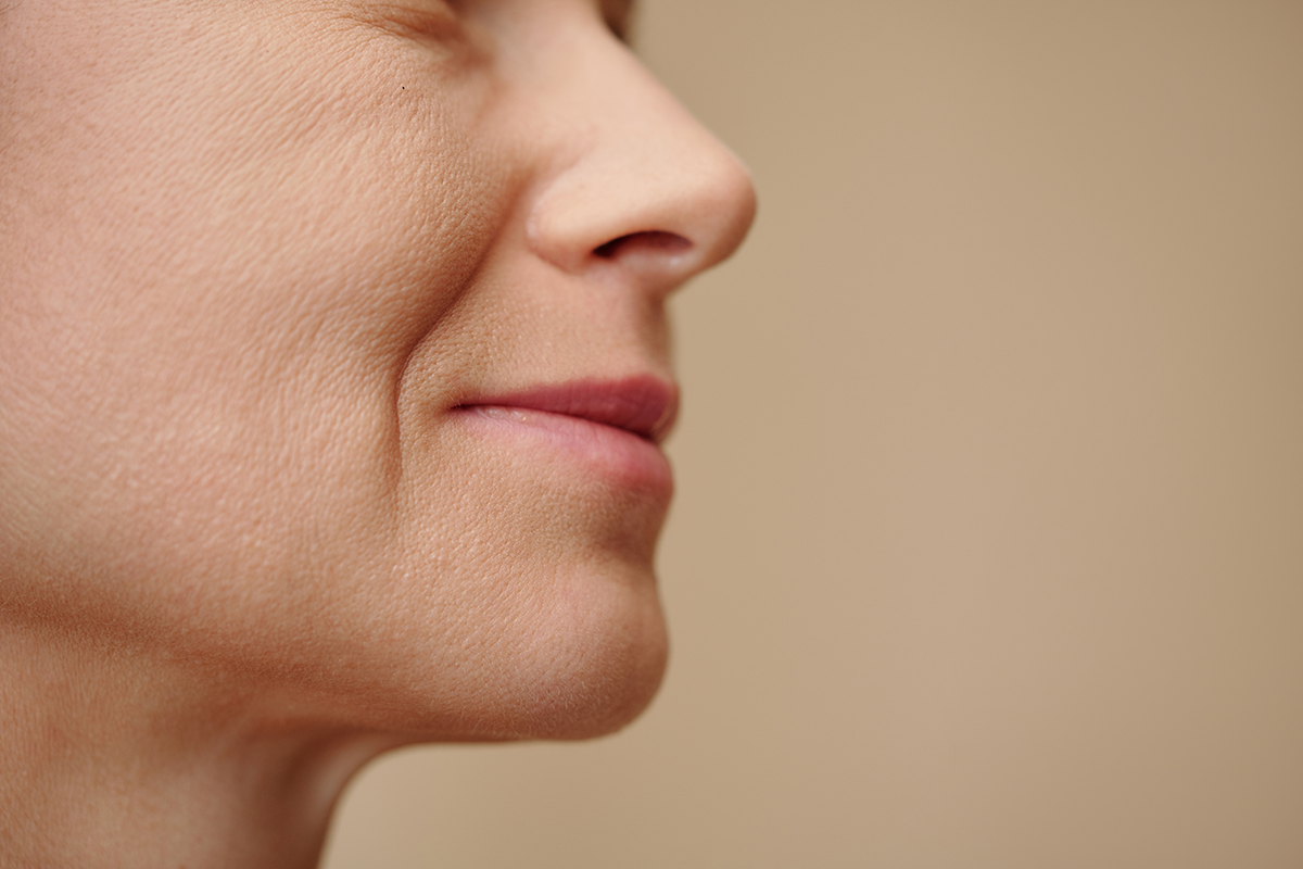 Face of middle-aged woman with nasolabial folds