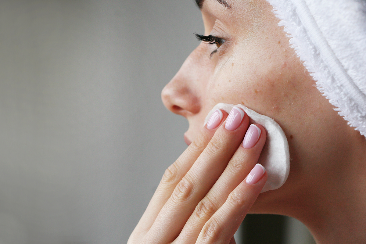 Girl with acne on face rubs face tonic