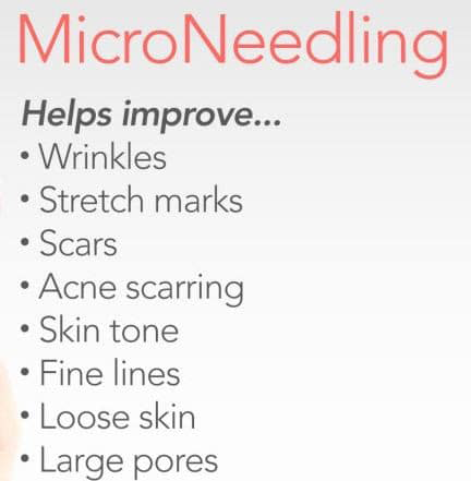 Microneedling specials