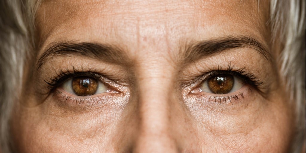 senior woman with blocked tear duct senior woman with blocked tear duct